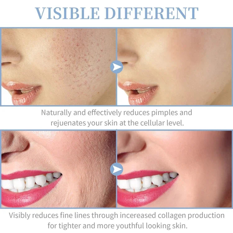 Portable Facial Machine