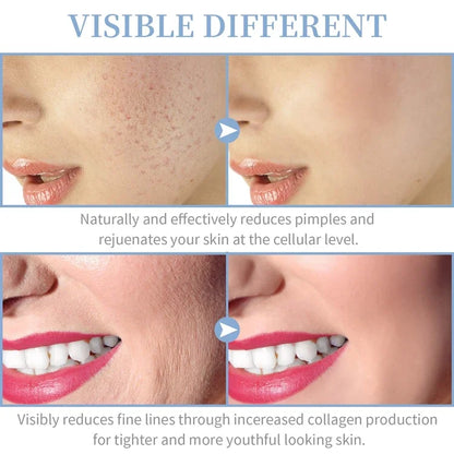 Portable Facial Machine