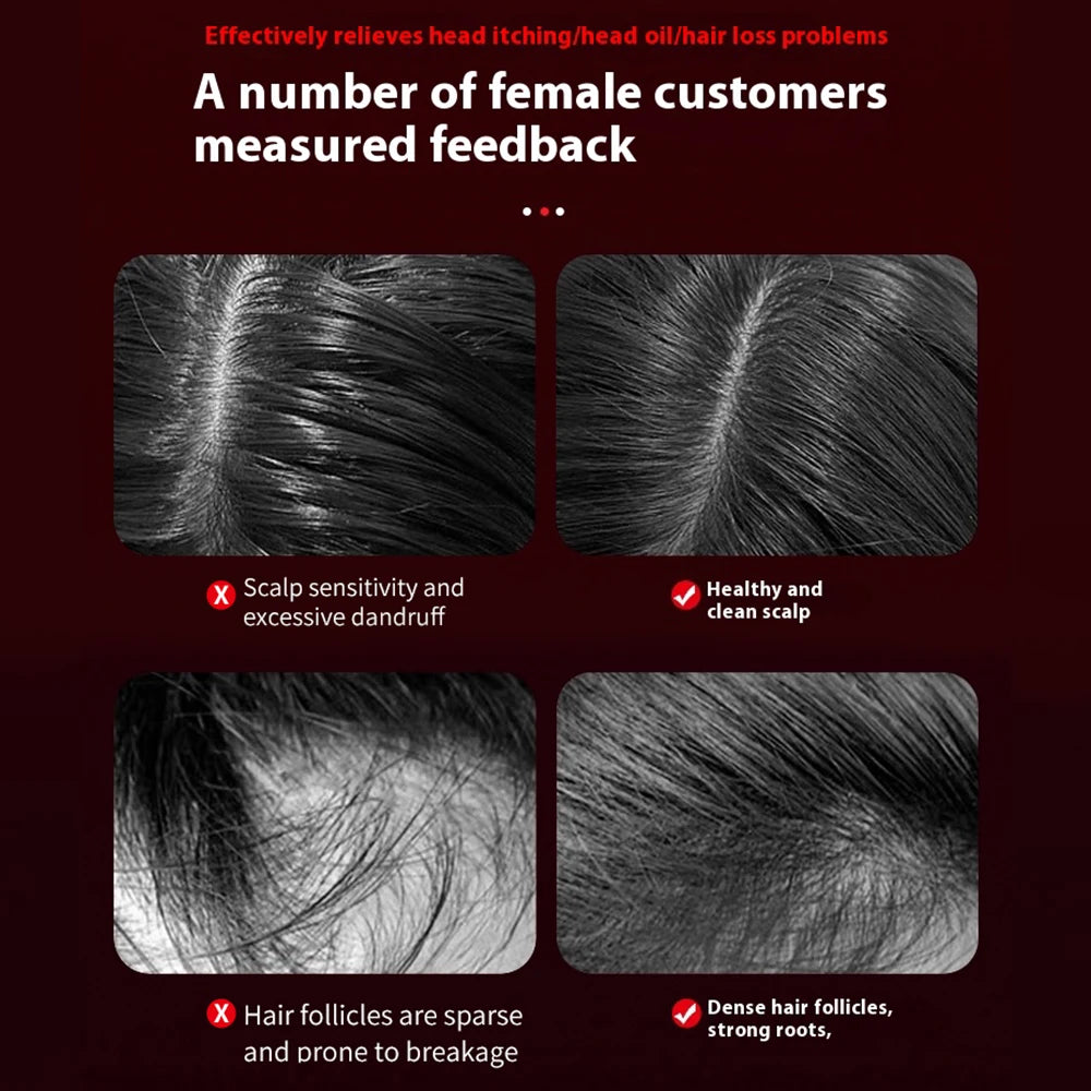 Laser Hair Comb